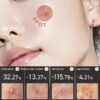 ANUA20Heartleaf20Centella20Red20Spot20Cream2030g2028429.jpg Anua Heartleaf Centella Red Spot Cream 30g