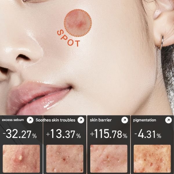 ANUA20Heartleaf20Centella20Red20Spot20Cream2030g2028429.jpg Anua Heartleaf Centella Red Spot Cream 30g