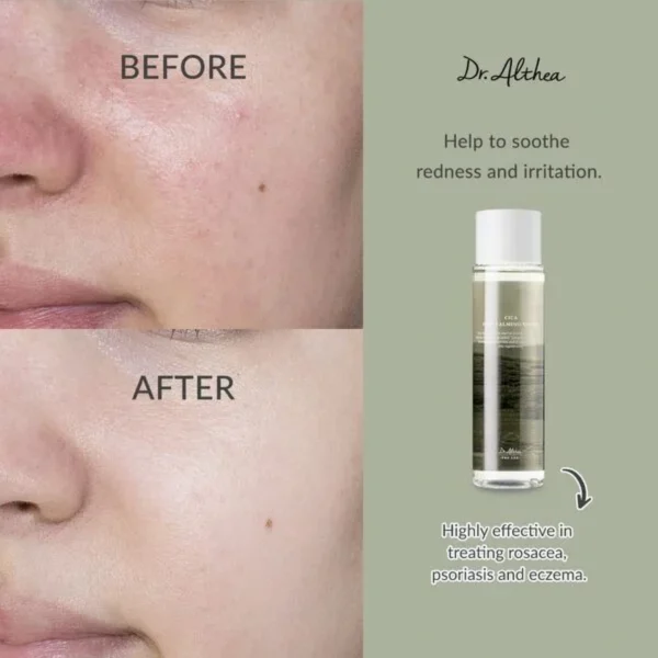 Dr. Althea Anastatica Skin Conditioning Toner 250ml