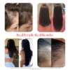 gummybefore_after.webp HAIRTAMIN – Gummy Stars 60 Gummies