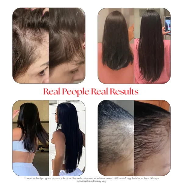 gummybefore_after.webp HAIRTAMIN – Gummy Stars 60 Gummies