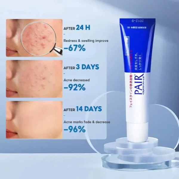 Lion- Pair Acne Cream W